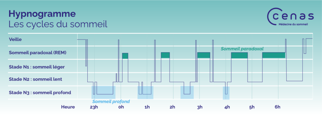 Article | Les Différentes Phases De Sommeil